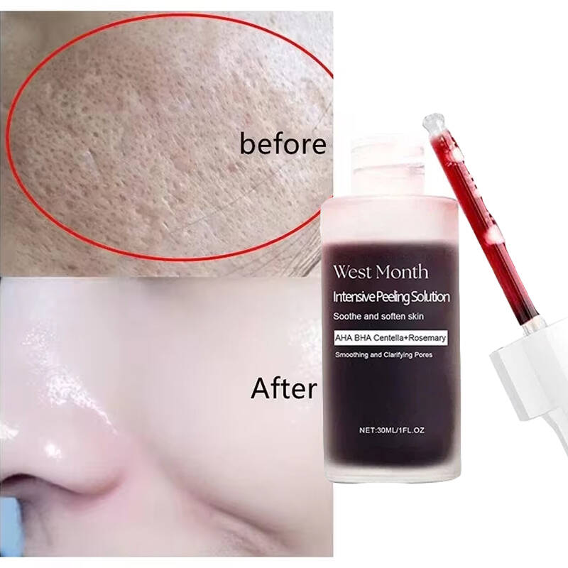 Tranexamic Acid Serum - Fühlt sich an wie Seide, sieht