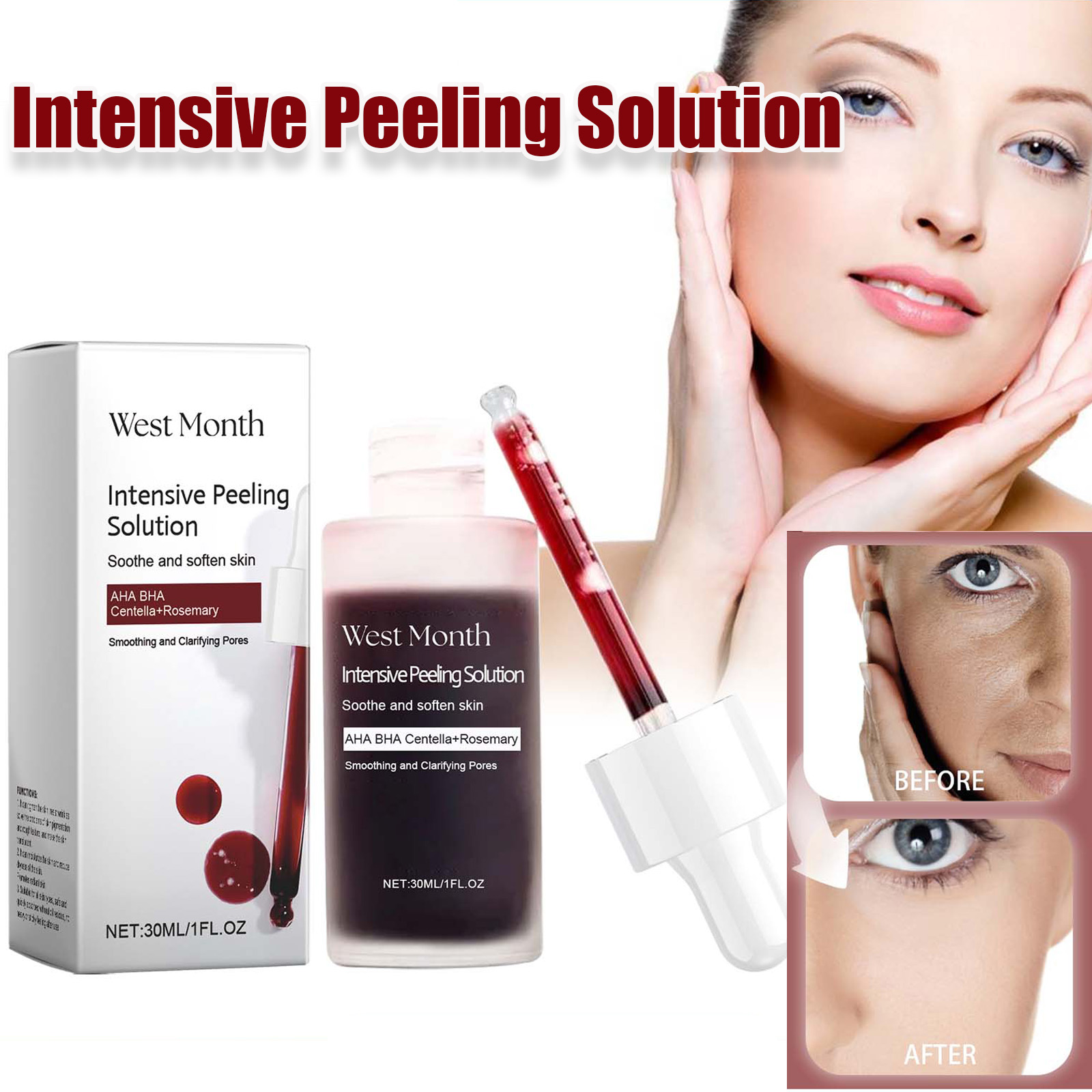 Tranexamic Acid Serum - Peeling Gesichtsserum Anti Akne Aufhellung Peeling