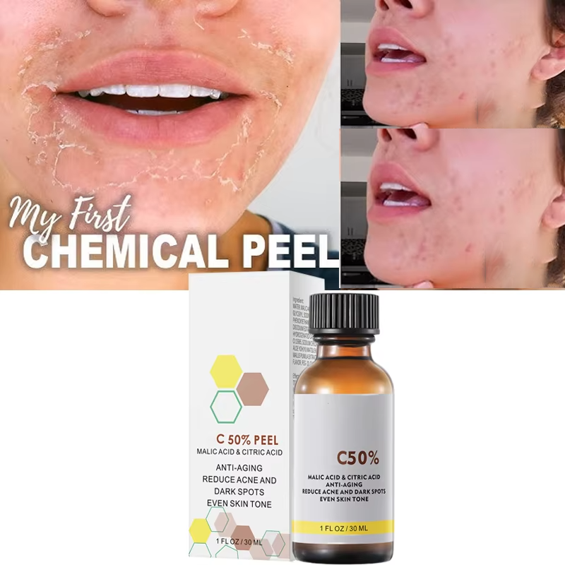 Tranexamic Acid Serum - Mit Malicsäure und Zitronensäure für das