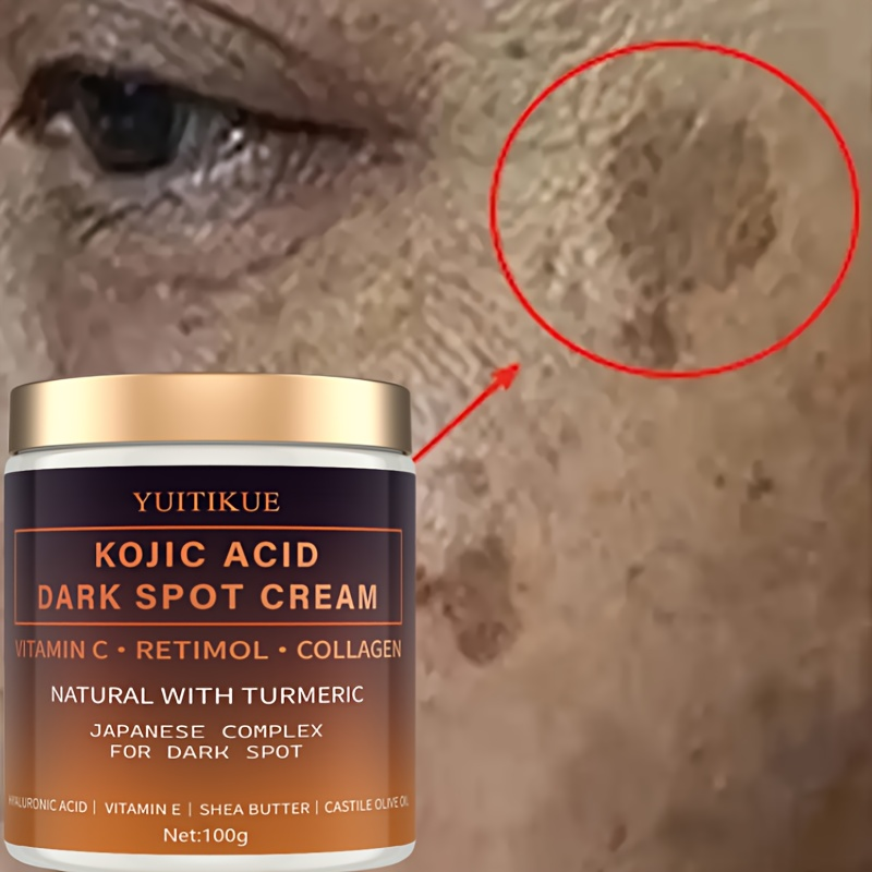 Retinol Vitamin A Cream - Arbutin-Fading-Creme, Vitamin C, Retinol, Kollagen, natürliches