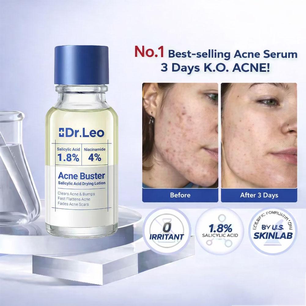 Salicylsäure-Essenz Behandlung – Tranexamic Acid Serum Bewertung und Preis