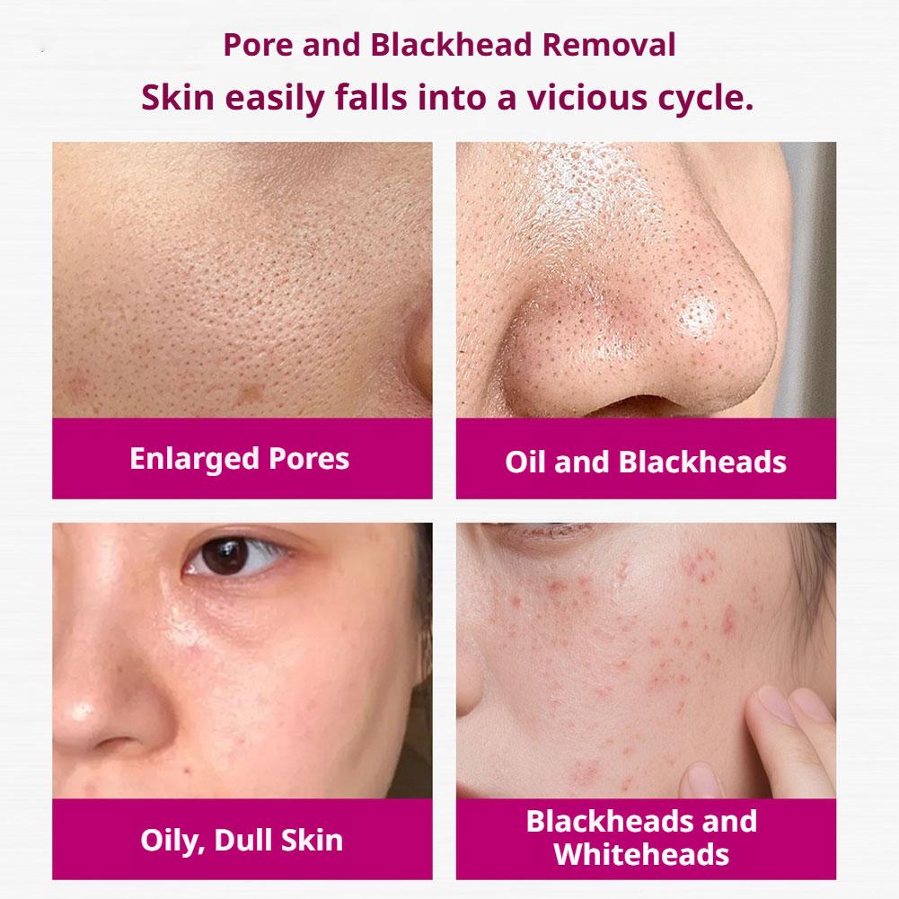 Salicylsäure-Serum zur Porenve – Tranexamic Acid Serum Bewertung und Preis