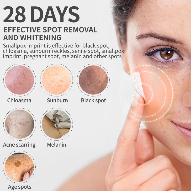 Dimollaure White ning Sommersp – Skincare Retinol Bewertung und Preis