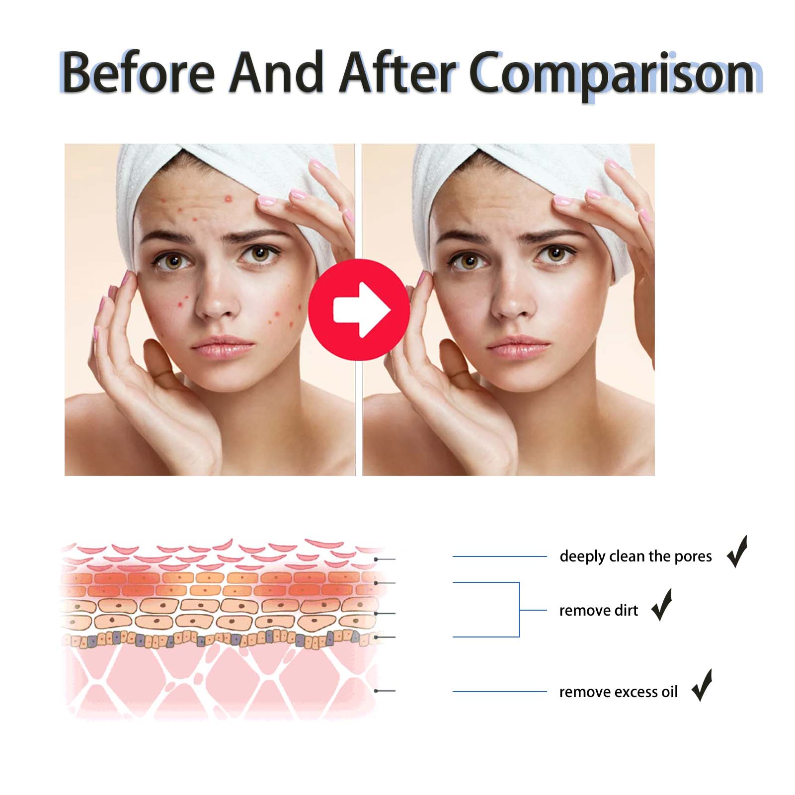 2% Salicylsäure Flüssiges Peel – Tranexamic Acid Serum Bewertung und Preis