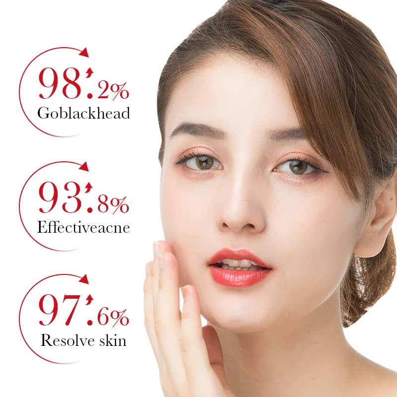 BIOAQUA Salicylsäure Akne Entf – Tranexamic Acid Serum Bewertung und Preis
