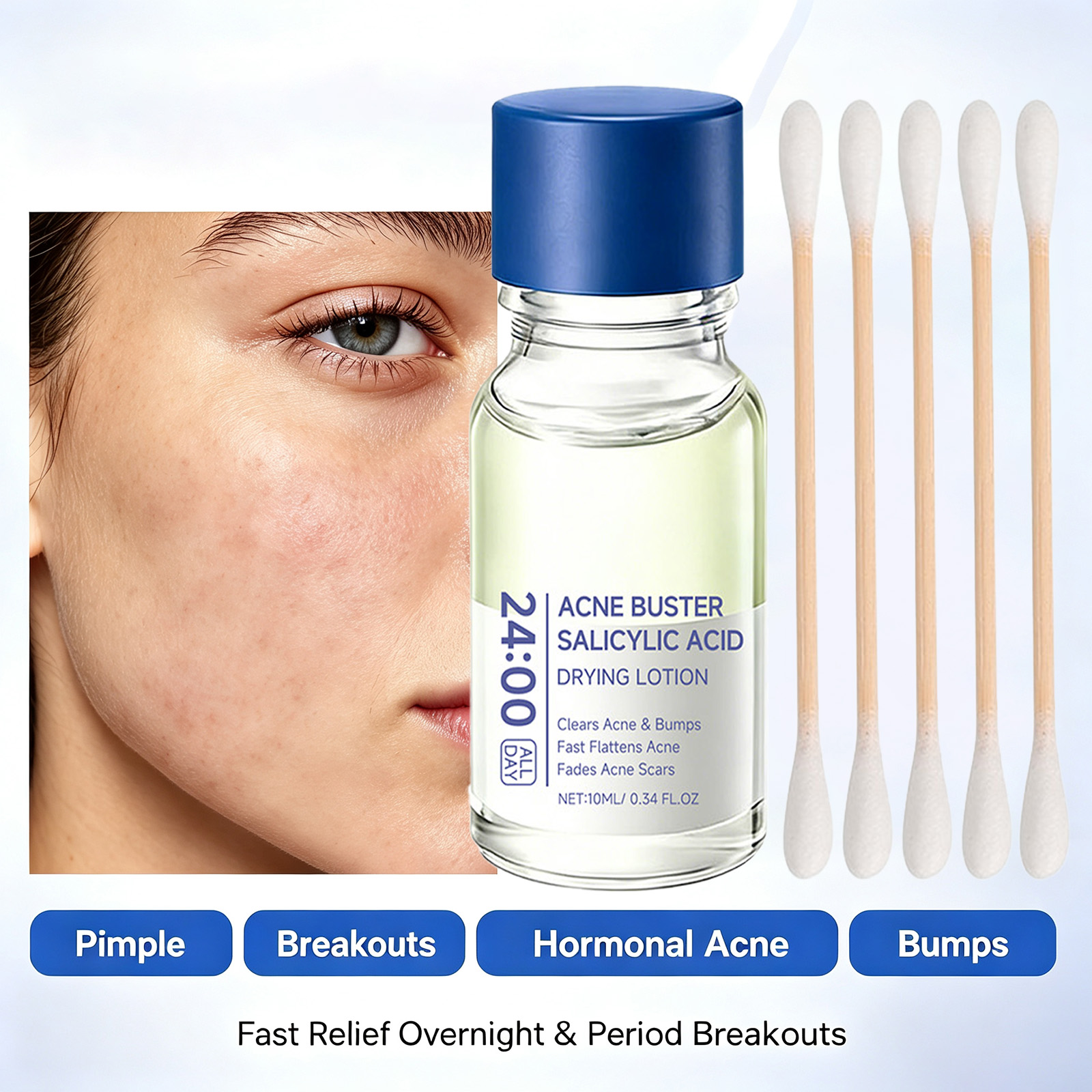 Salicylsäure Akne-Behandlungss – Tranexamic Acid Serum Bewertung und Preis
