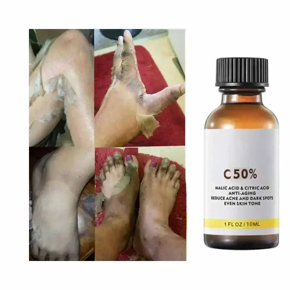 Mit Malicsäure und Zitronensäu – Tranexamic Acid Serum Bewertung und Preis